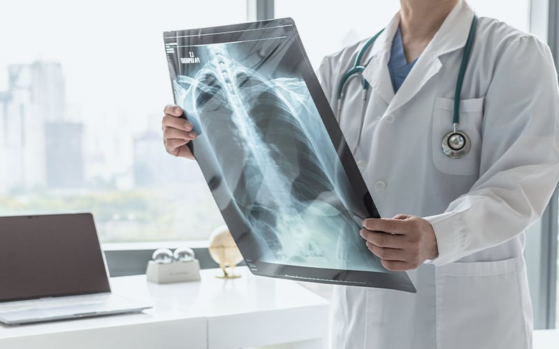 A doctor examining a chest X-ray