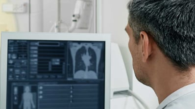 Provider looking at lung scan