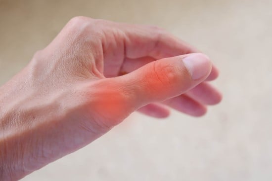 Hand with radiating pain